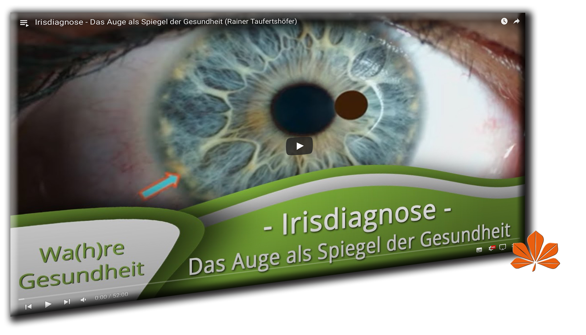 VIDEO_Irisdiagnose_Das_Auge_als_Spiegel_der_Gesundheit_Rainer_Taufertshöfer